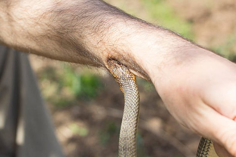 Dream That A Snake Bites You - Spiritual And Biblical Meaning